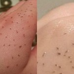 Korisnica Redita postavila je fotografiju na kojoj se vidi šta se dešava nakon postupka