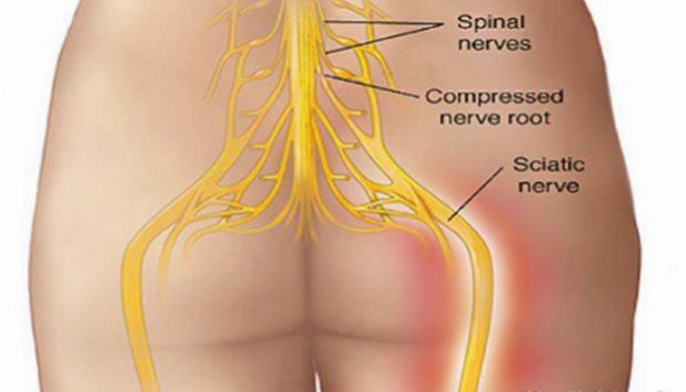 resite-se-boli-u-ledjima