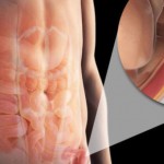 preponska-kila-naslovna-580x290