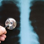 ciscenje-jacanje-pluca