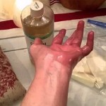 ricinusovo-ulje-zglobovi